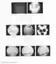 Fig. 02 - FERMENTED MILK PRODUCT AND USE THEREOF