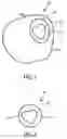 Fig. 02 - Method and apparatus for nature decorating fruit as such fruit is being ripened on the tree