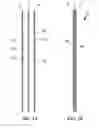 Fig. 02 - HIGH INTEGRITY COMPOSITE BAGS ADAPTED FOR STEAM STERILIZATION
