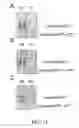 Fig. 16 - YEAST BASED EXPRESSION OF PROTEASES AND METHODS OF USE