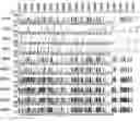 Fig. 01 - Methods for determining dysregulation of methylation of brain expressed genes on the X chromosome to diagnose autism spectrum disorders