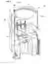 Fig. 03 - Modulated metal removal using localized wet etching