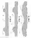 Fig. 05 - SLIP JOINT FOR USE IN A DRIVE TRAIN SYSTEM