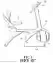 Fig. 02 - Exercising device