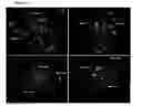 Fig. 03 - Alpha1 proteinase inhibitor peptides methods and use