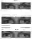 Fig. 07 - Compositions and methods for reversing rebound hyperemia