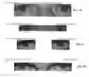 Fig. 05 - Vasoconstriction compositions and methods of use