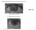 Fig. 06 - Vasoconstriction compositions and methods of use
