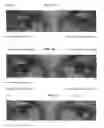 Fig. 07 - Vasoconstriction compositions and methods of use