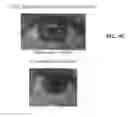 Fig. 06 - Compositions and methods for reducing activation of alpha-1 receptors