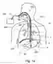 Fig. 02 - Interactive NGT system