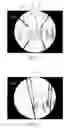 Fig. 04 - System for positioning of surgical inserts and tools