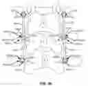 Fig. 22 - Modular in-line deflection rod and bone anchor system and method for dynamic stabilization of the spine