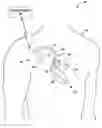 Fig. 01 - Using multiple diagnostic parameters for predicting heart failure events
