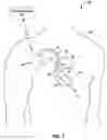 Fig. 02 - Using multiple diagnostic parameters for predicting heart failure events