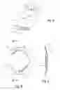 Fig. 03 - Intraocular Lens System