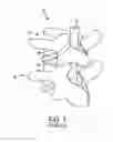 Fig. 02 - Spine Surgery Technique And System