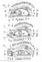Fig. 06 - ENERGY RETURNING PROSTHETIC JOINT
