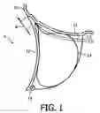 Fig. 02 - Method for mutually adhering moulded articles of vulcanized rubber and of polymer