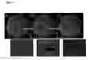 Fig. 04 - METHOD AND SYSTEM OF ARRAY IMAGING