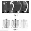 Fig. 02 - METHODS AND SYSTEMS FOR PET/CT SCANNING FOR EVALUATION OF MALIGNANCY