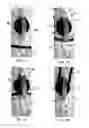Fig. 03 - Pulley