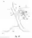 Fig. 05 - SHOOTING GALLERY DEVICES AND METHODS