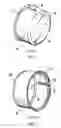 Fig. 02 - Hubcap for aircraft wheel