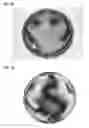 Fig. 04 - Polarizing lens and method of its manufacture