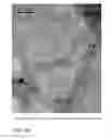 Fig. 07 - Composite containing carbonized biopolymers and carbon nanotubes and method of making the composite