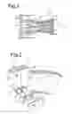 Fig. 02 - Vibration damper assembly