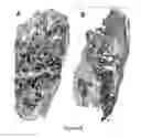 Fig. 08 - Osteoinductive calcium phosphates