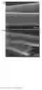Fig. 02 - Carbon microtubes