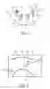 Fig. 02 - Dental tool for the fitting, installation and replacement of a dental prosthetic attachment