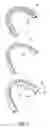 Fig. 02 - ARTIFICIAL TEETHRIDGE AND FANG
