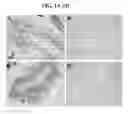 Fig. 02 - COMPOSITIONS AND METHODS FOR TISSUE-BASED PROTEIN TRUNCATION TEST FOR DISEASE DIAGNOSIS