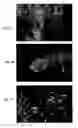 Fig. 02 - COMPOUNDS AND METHODS FOR DETECTION OF CELLS
