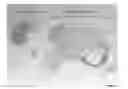 Fig. 01 - Human embryonic stem cell-derived connective tissue progenitors for tissue engineering