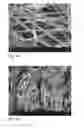 Fig. 13 - Human embryonic stem cell-derived connective tissue progenitors for tissue engineering