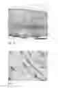 Fig. 15 - Human embryonic stem cell-derived connective tissue progenitors for tissue engineering