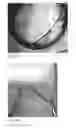 Fig. 16 - Human embryonic stem cell-derived connective tissue progenitors for tissue engineering