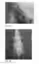 Fig. 23 - Human embryonic stem cell-derived connective tissue progenitors for tissue engineering