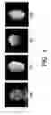 Fig. 02 - Automatic Methods for Combining Human Facial Information with 3D Magnetic Resonance Brain Images