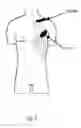 Fig. 02 - METHOD OF UTILISING MEASUREMENTS OF THRESHOLD OF PAIN
