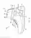Fig. 08 - Support device for a joint