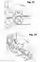 Fig. 08 - Absorbent article including absorbent core having a plurality of first regions and a second region surrounding each of the first regions