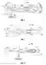 Fig. 02 - Polyp removal device and method of use