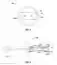 Fig. 03 - Polyp removal device and method of use