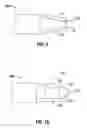Fig. 05 - Polyp removal device and method of use