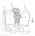 Fig. 04 - FUSION CAGE WITH REVERSE THREAD PROFILE (RTP)